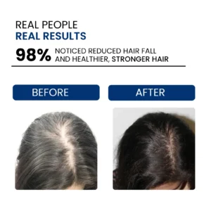 herbal anti hair fall serum for daily use